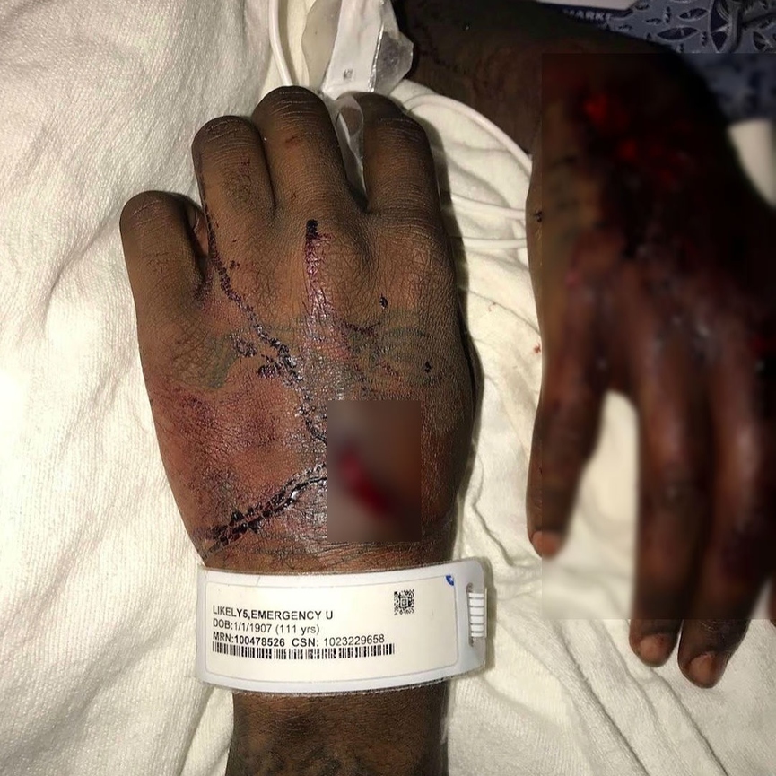 У Offset’а травмированы руки​Фото: Instagram