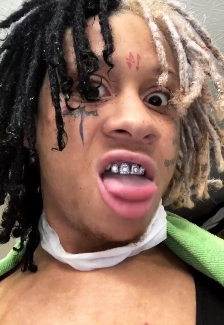 Trippie Redd сделал прическу в стиле Х​Фото: Instagram