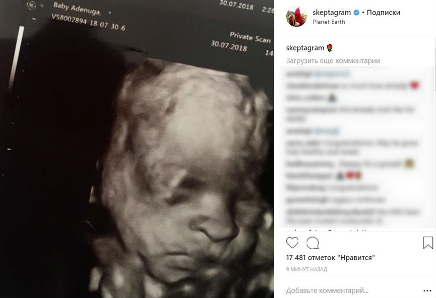 Skepta поздравляют с отцовством